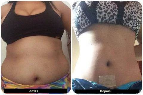 Adesivo Detox Slim Patch Perda de Gordura Localizada